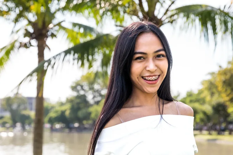 Smiling woman in tropical outdoor setting showing genuine warmth